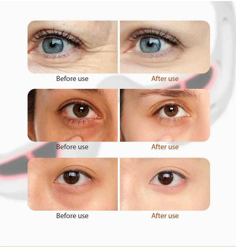 Red Light EMS Eye Care Massager